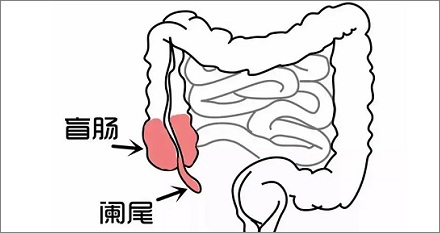 为什么人类要长阑尾