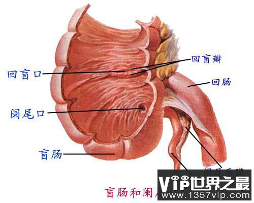 阑尾真的没用吗 阑尾有什么用