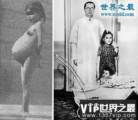 世界上最大的婴儿，出生既37斤(等同于6岁孩子体重)(img.1221vip.com)