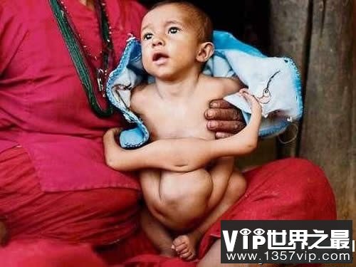 世界上腿最多的女人，四腿女子如何过性生活(img.1221vip.com)