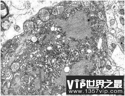 人类历史上12种最致命病毒，冠状病毒上榜