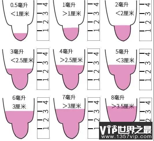 精子量参照图